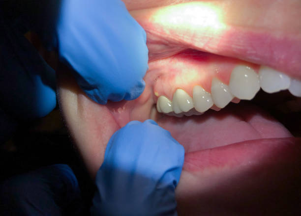 Best Emergency Care for Gum Disease in Stockdale, TX
