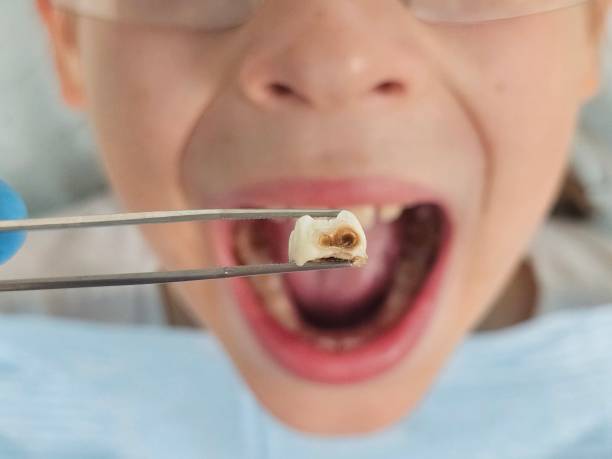 Best 24-Hour Emergency Dental Care in Stockdale, TX